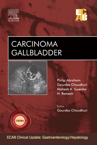 Carcinoma gallbladder