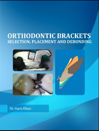 Orthodontic Bracket Selection Preview