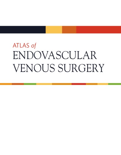 Atlas of Endovascular Venous Surgery