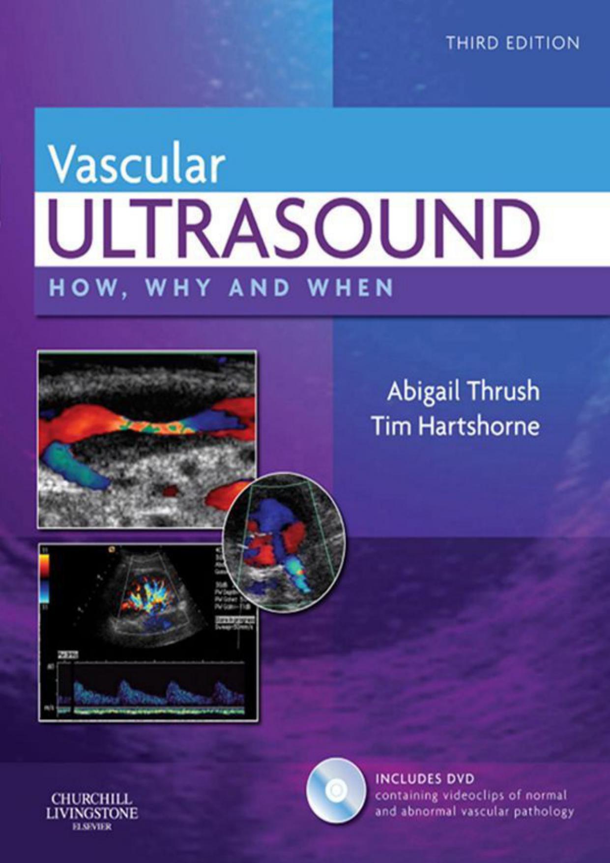 Vascular Ultrasound E-Book (How, Why and When)