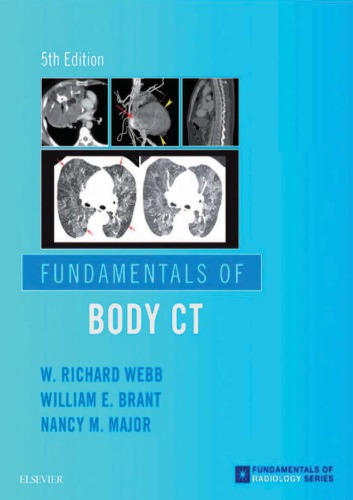 Fundamentals of Body CT