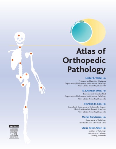 Atlas of Orthopedic Pathology