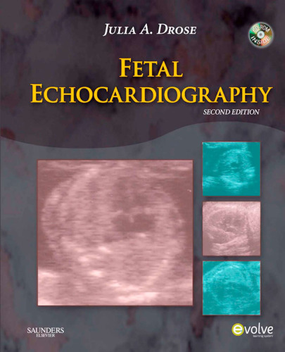 Fetal Echocardiography