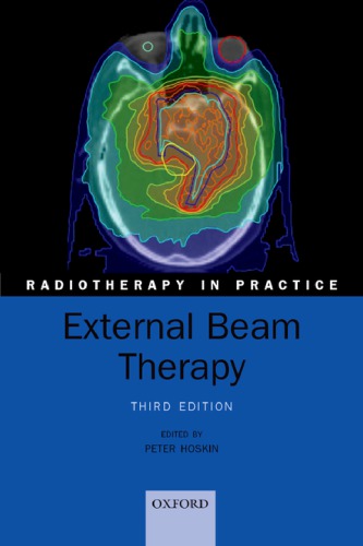 External Beam Therapy