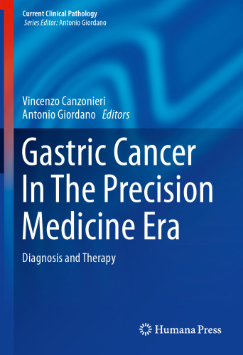 Gastric Cancer In The Precision Medicine Era: Diagnosis and Therapy