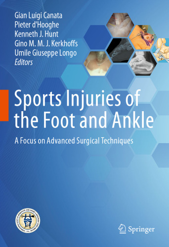 Sports Injuries of the Foot and Ankle: A Focus on Advanced Surgical Techniques