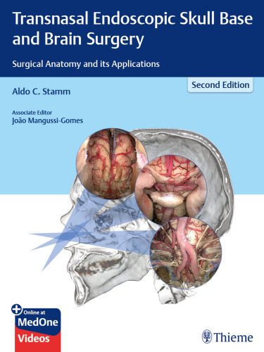 Transnasal endoscopic skull base and brain surgery : surgical anatomy and its applications