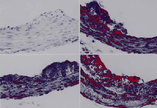 Atherosclerosis: Experimental Methods and Protocols