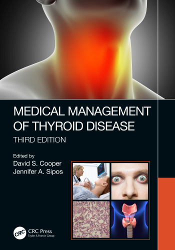 Medical management of thyroid disease