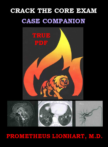 Crack the core exam case companion