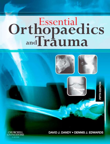 Essential Orthopaedics and Trauma