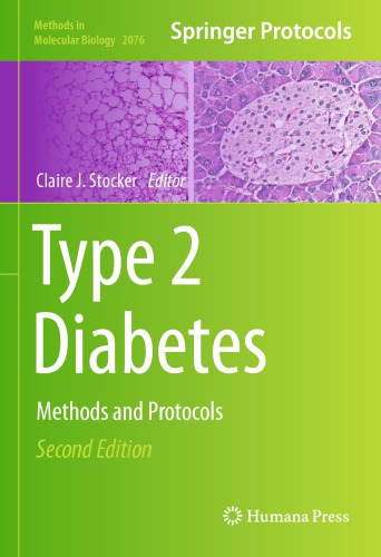 Type 2 Diabetes: Methods and Protocols
