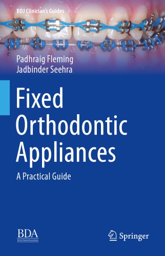 Fixed Orthodontic Appliances: A Practical Guide