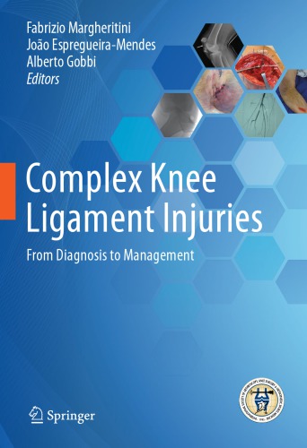 Complex Knee Ligament Injuries: From Diagnosis to Management