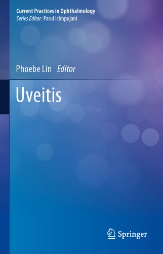 Uveitis