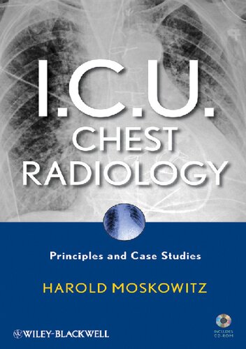 I.C.U. Chest Radiology: Principles and Case Studies