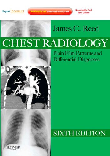 Chest Radiology: Plain Film Patterns and Differential Diagnoses