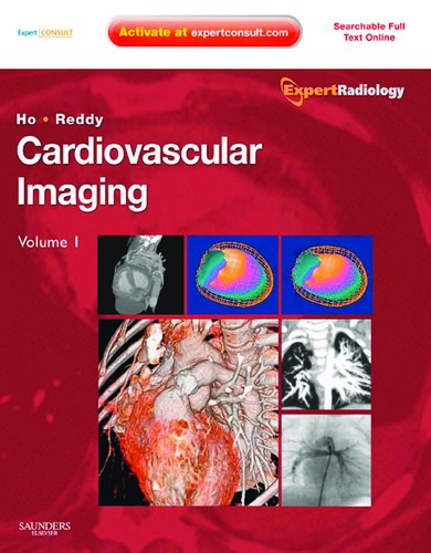 Cardiovascular imaging