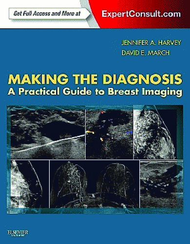 Making the Diagnosis: A Practical Guide to Breast Imaging