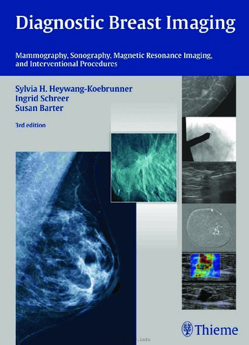 Diagnostic Breast Imaging: Mammography, Sonography, Magnetic Resonance Imaging, and Interventional Procedures