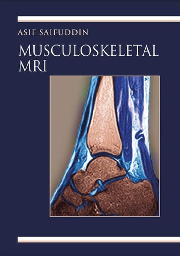 Musculoskeletal MRI
