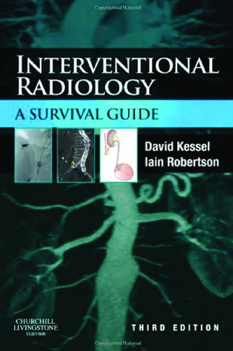 Interventional Radiology: A Survival Guide