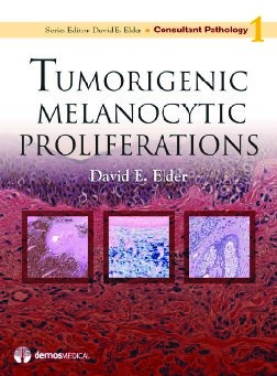 Tumorigenic Melanocytic Proliferations