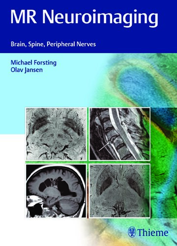 MR Neuroimaging: Brain, Spine, and Peripheral Nerves