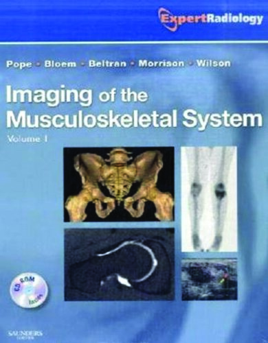 Imaging of the Musculoskeletal System