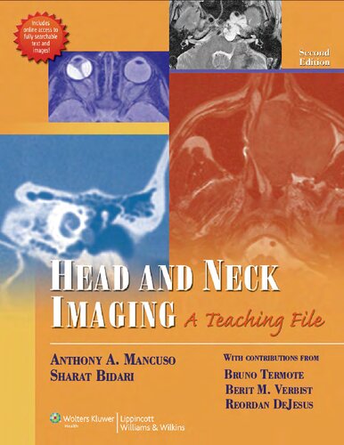 Head and Neck Imaging