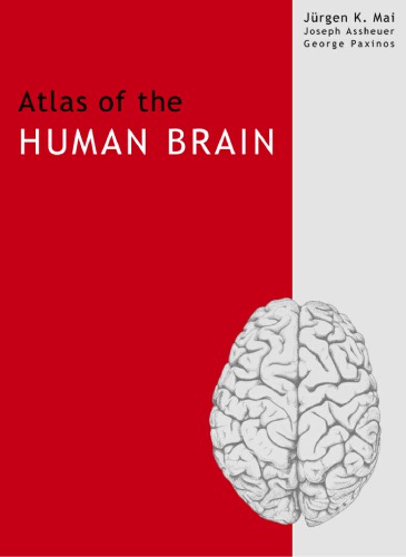 Atlas of the Human Brain, Second Edition