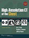 High-Resolution CT of the Chest: Comprehensive Atlas