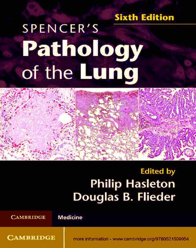 Spencer's Pathology of the Lung
