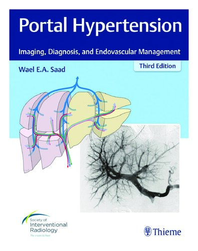 Portal Hypertension: Imaging, Diagnosis, and Endovascular Management