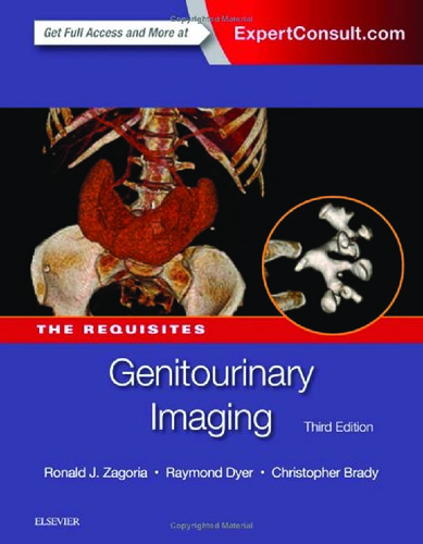 Genitourinary Imaging: The Requisites