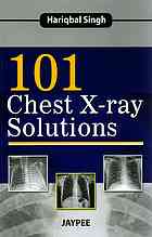 101 Chest X-ray Solutions