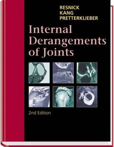 Internal Derangements of Joints