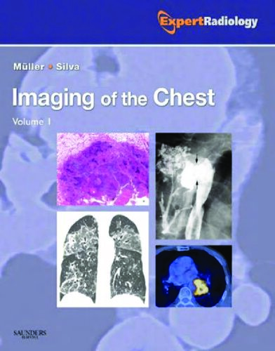 Imaging of the Chest