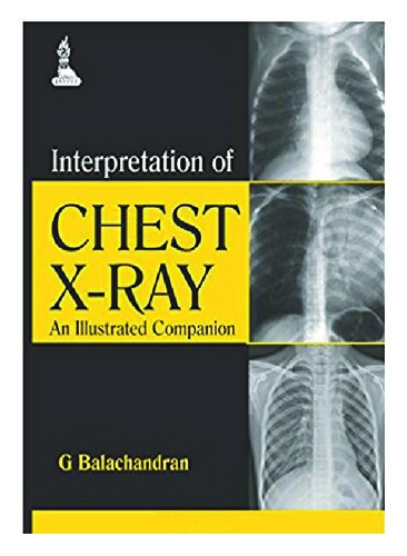 Interpretation of Chest X-Ray: An Illustrated Companion