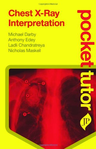 Chest X-Ray Interpretation