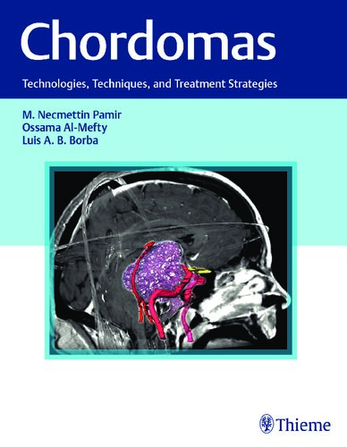 Chordomas: Technologies, Techniques, and Treatment Strategies