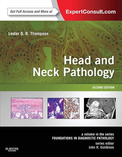 Head and Neck Pathology: A Volume in the Series: , 2e