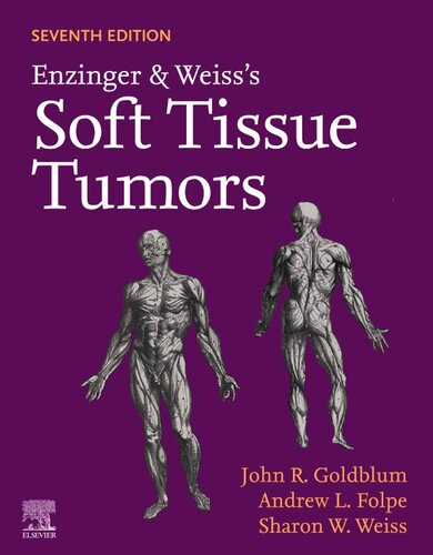 Enzinger and Weiss's Soft Tissue Tumors