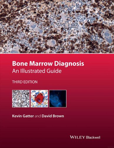 Bone Marrow Diagnosis: An Illustrated Guide