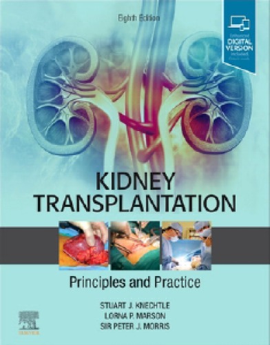 Kidney Transplantation: Principles and Practice