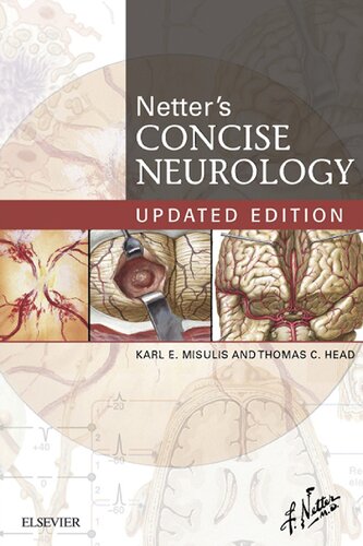 Netter's Concise Neurology Updated Edition