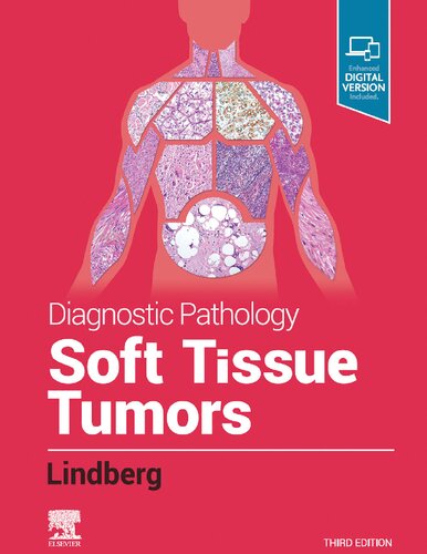 Diagnostic Pathology: Soft Tissue Tumors