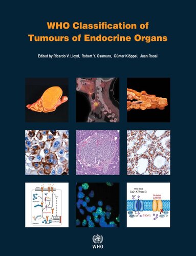 WHO Classification of Tumours of Endocrine Organs