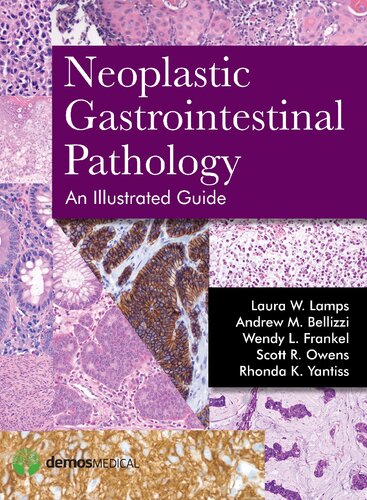 Neoplastic gastrointestinal pathology : an illustrated guide