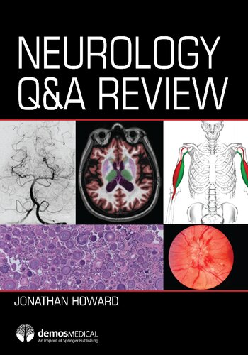 Neurology Q & A review